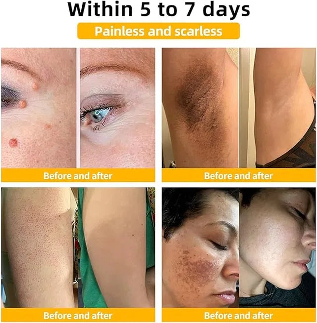 Zidella Skin Lighting Blemish Cream 50g (Pack of 2)