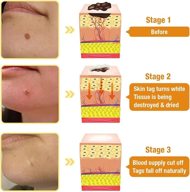 Zidella Skin Lighting Blemish Cream 50g (Pack of 2)